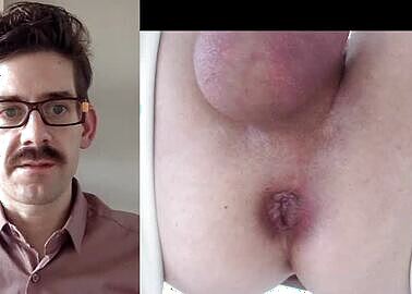 The Male Rectum