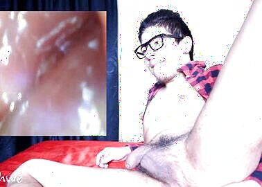 A Look Inside the Rectum and Anal Canal For Science